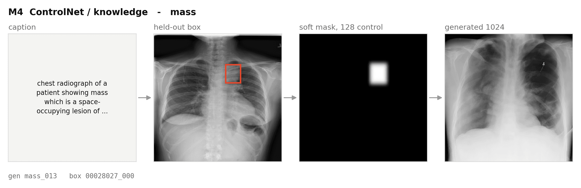 Knowledge-Guided Diffusion for Medical Imaging cover